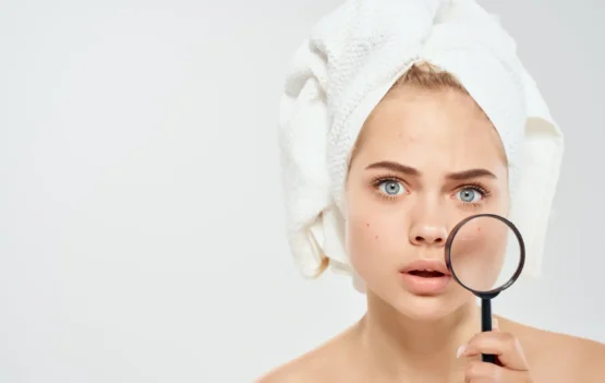 Epicure Salon Bőrproblémák kezelése