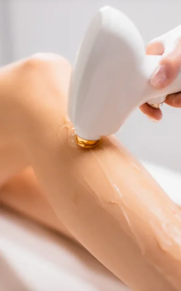 Epicure Salon Lézeres Szőrtelenítés